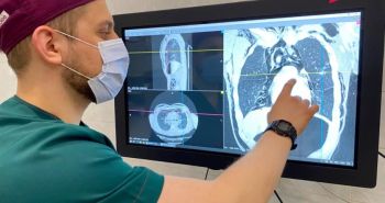 Искусственный интеллект помогает пациентам получать результаты исследований